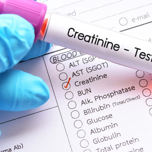 How to Analyze a Creatinine Level Chart