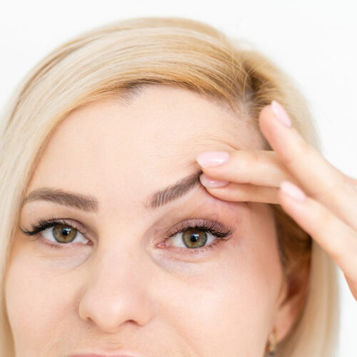 Management Options to Fix Droopy Eyelids