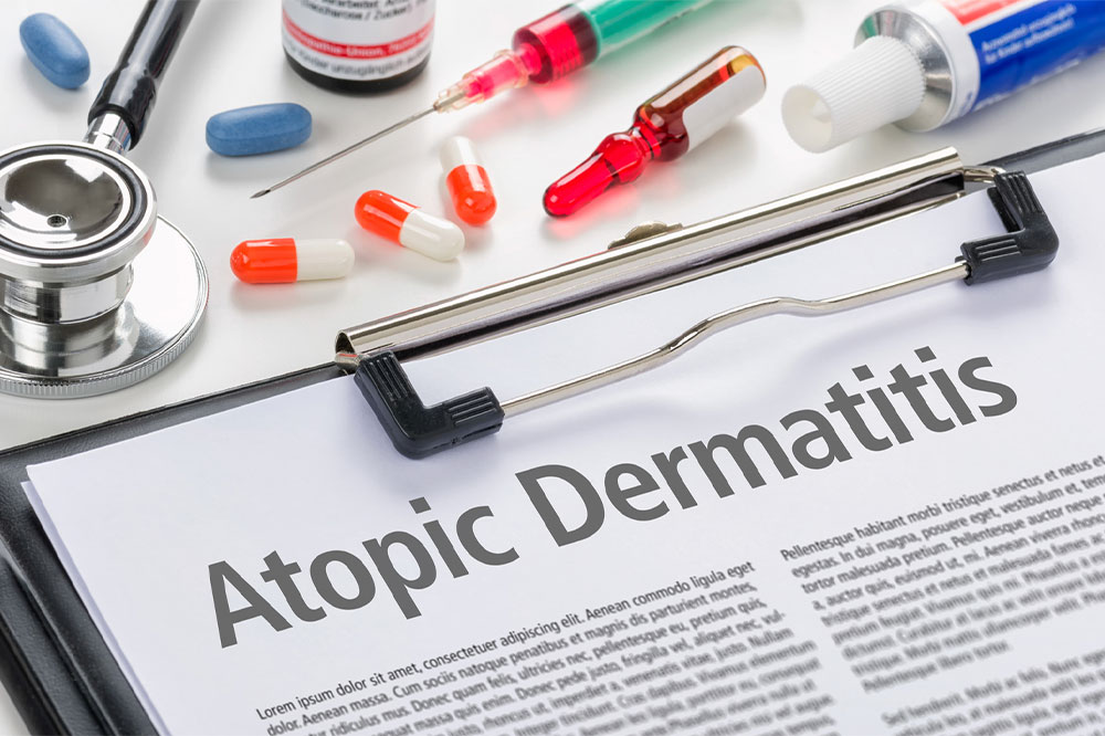 Measures to Manage and Prevent Atopic Dermatitis