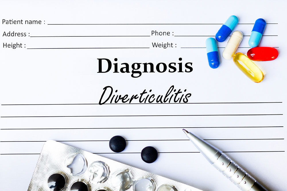 Diverticulitis &#8211; Causes, Symptoms, and How to Manage the Condition