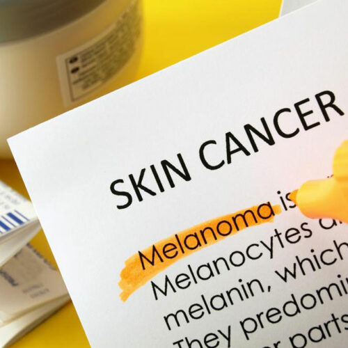 An overview of skin cancer