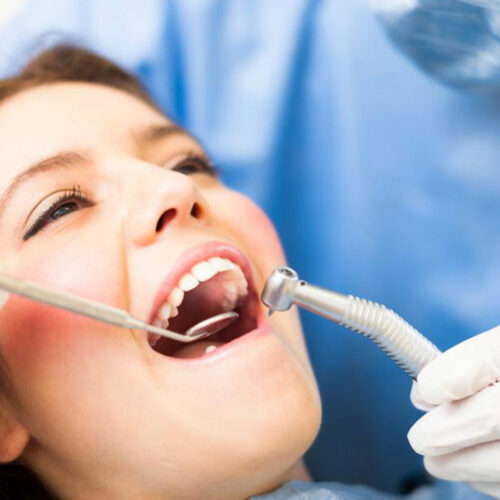 Best supplemental dental insurance policies