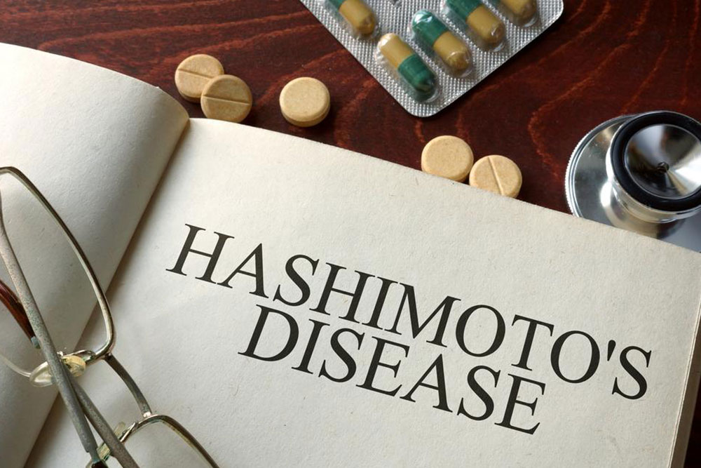 Causes and symptoms of hashimotos disease