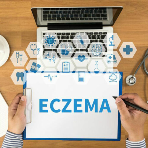 Everything you need to know about eczema