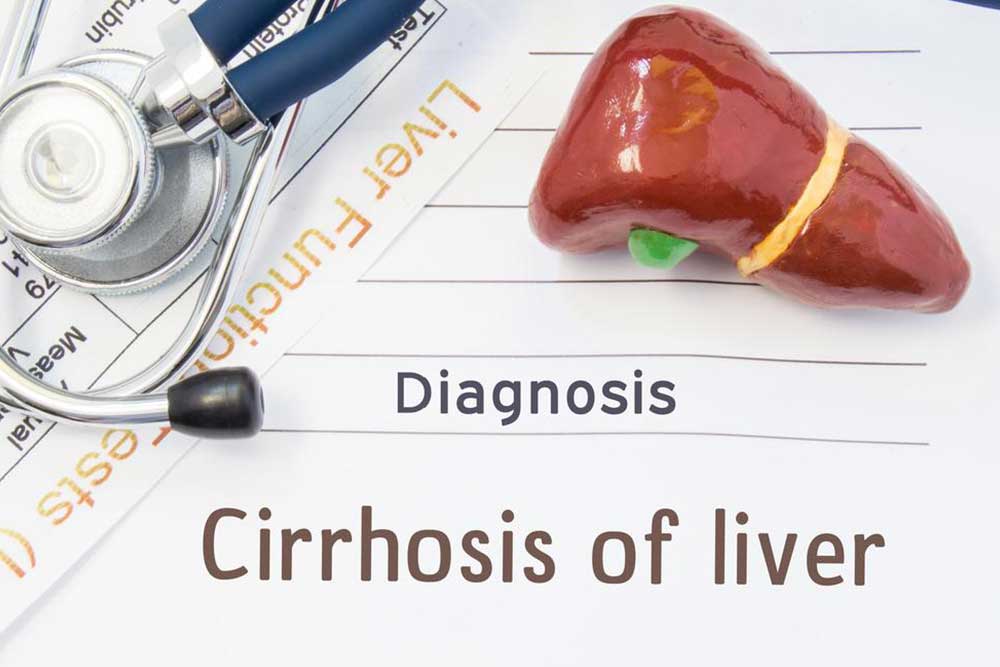 Liver Cirrhosis and its 4 Stages