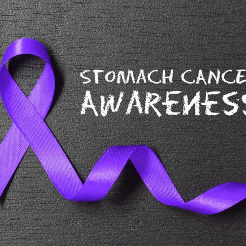 Stomach Cancer, symptoms you should be aware of