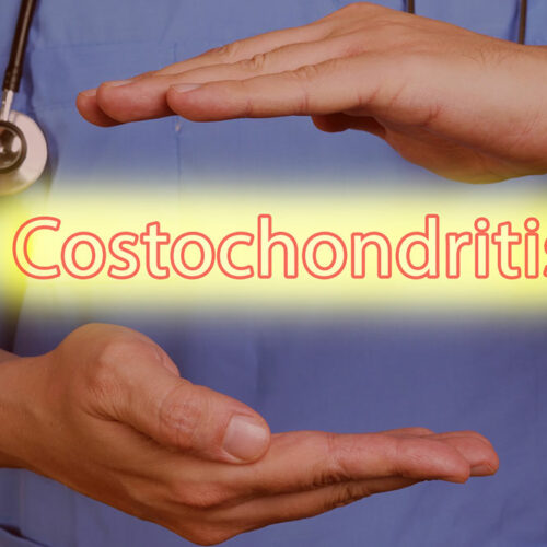 Symptoms, Causes, and Management of Costochondritis