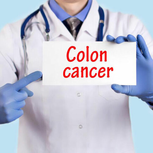 Signs and symptoms of colon cancer