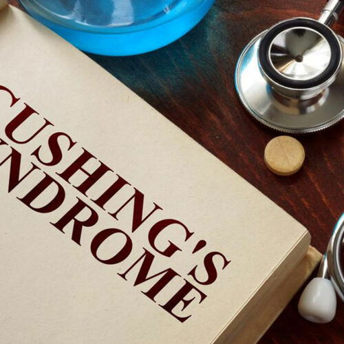 The symptoms of Cushing&#8217;s disease