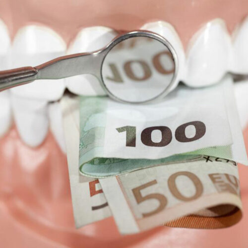 Things to know before buying dentures