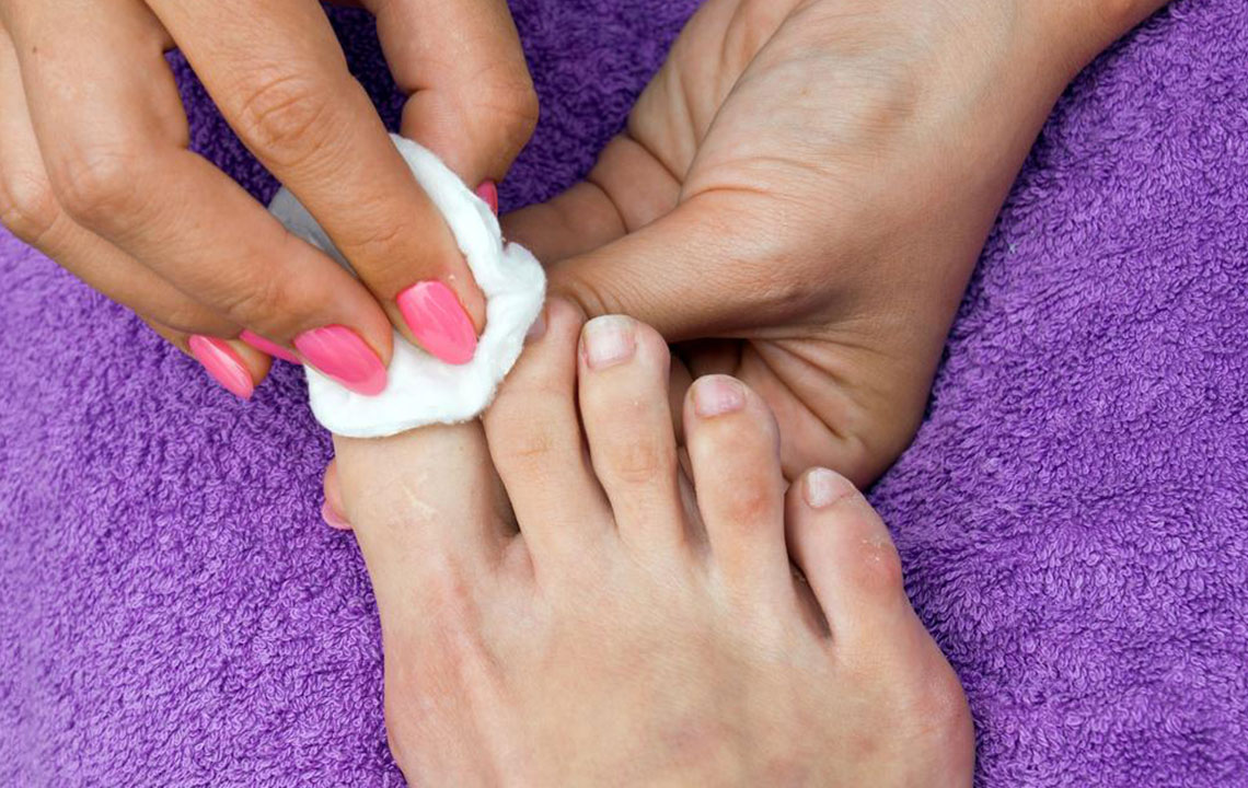 Ways to Cure Nail Fungus