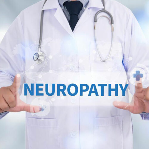 Neuropathy &#8211; Types, Causes, and Symptoms