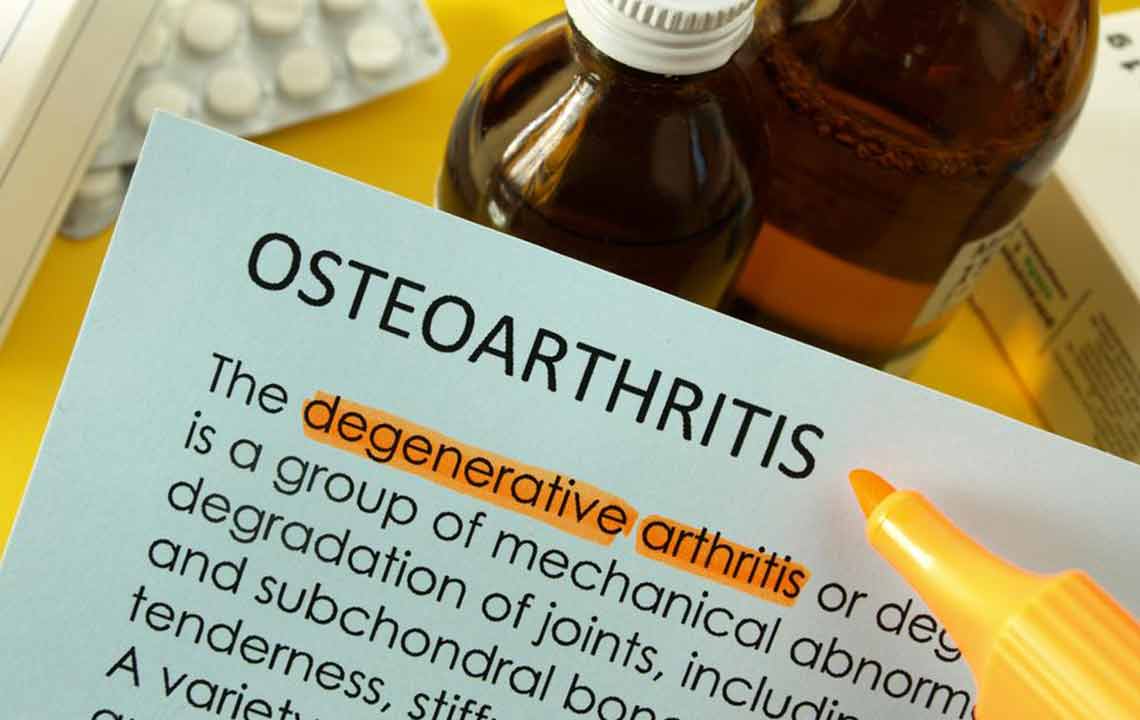 Osteoarthritis: Causes, symptoms, and treatments