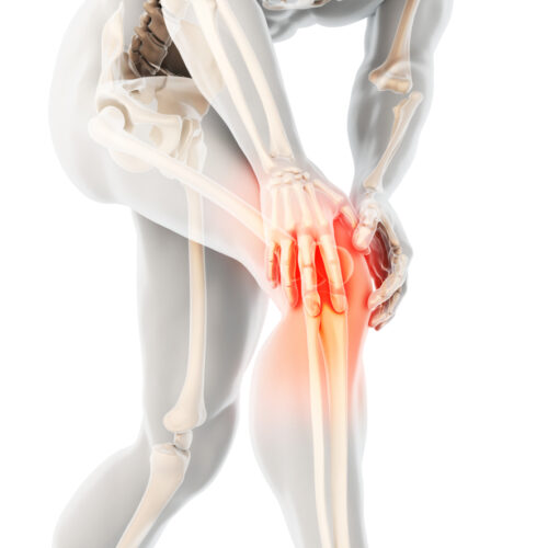 Osteoarthritis And Osteoporosis &#8211; Symptoms, Differences And Treatments