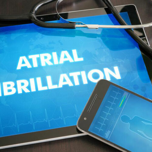 Atrial Fibrillation Treatment Options That Can Save Your Heart and Life