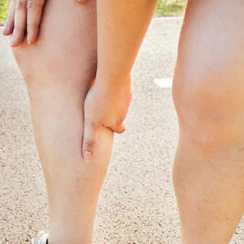 A Brief Insight Into The Symptoms Causes And Treatment Of Deep Vein Thrombosis