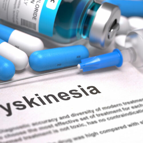 All You Need to Know About Tardive Dyskinesia