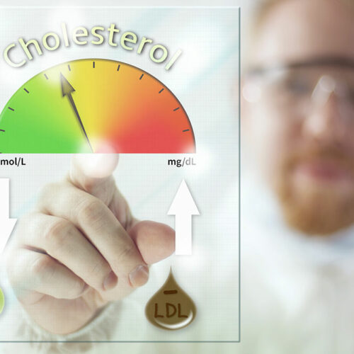 All You Need to Know about High Cholesterol Levels