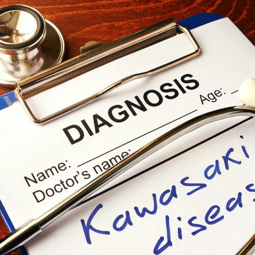 Diagnosis and treatment of Kawasaki disease