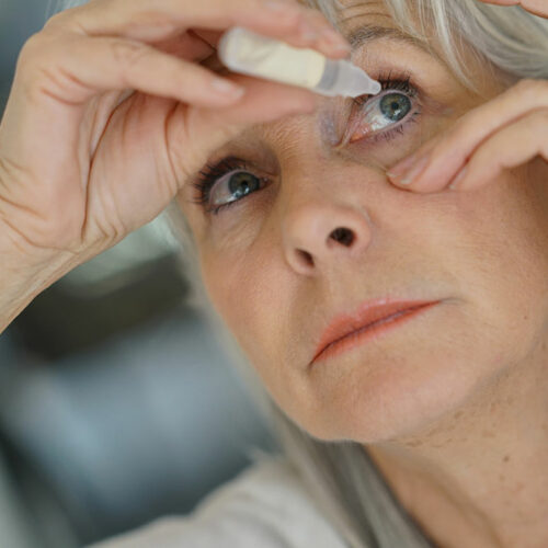 Dry eyes &#8211; Symptoms, causes, and treatment