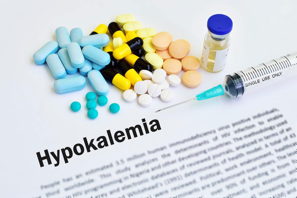 Hypokalemia &#8211; what you should know