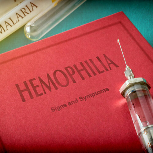 Hemophilia &#8211; 4 main symptoms and their severity