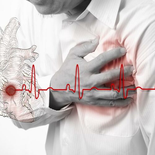 Symptoms And Treatment For Atrial Fibrillation