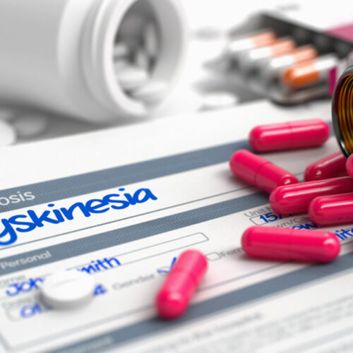 Treatment options for dyskinesia