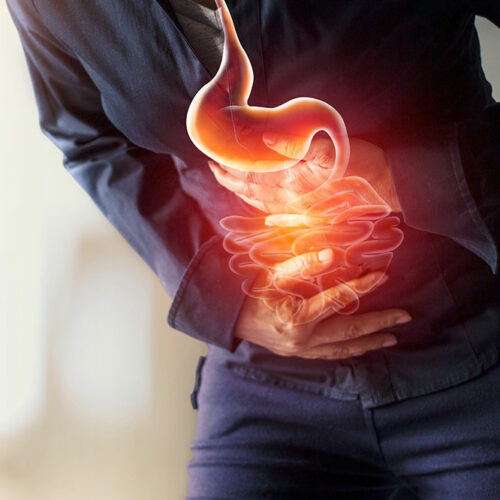 Understanding gastritis &#8211; A common stomach condition