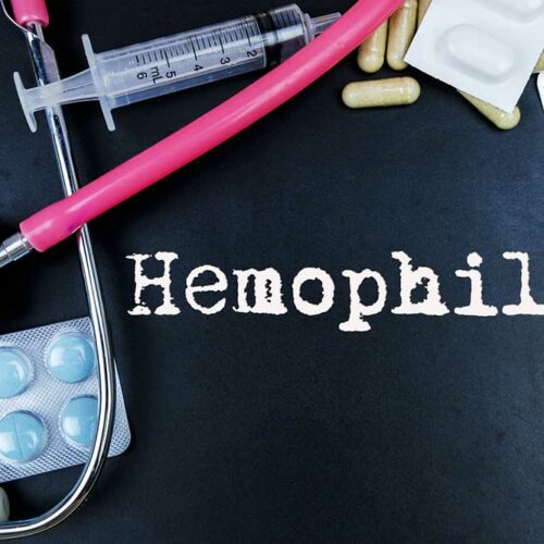 7 Common Ways to Treat Hemophilia