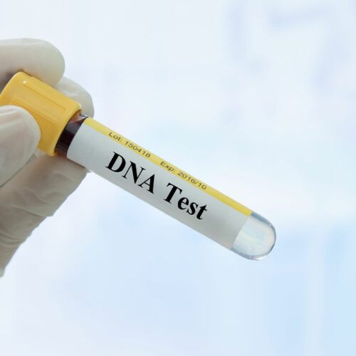 Things to Know Before Taking a DNA Test